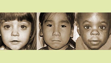 child with fasds
