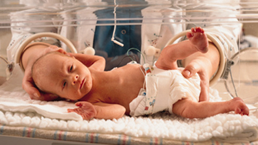 Premature baby in an incubator.
