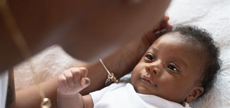 Uneven Head Shape in Babies: Causes and Treatment of Craniosynostosis