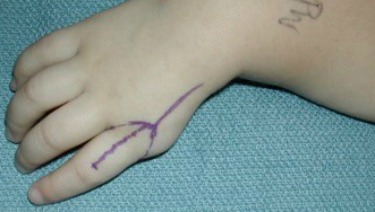 Club Hand - Example