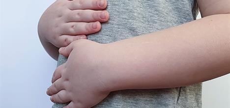Gallbladder Disease in Children