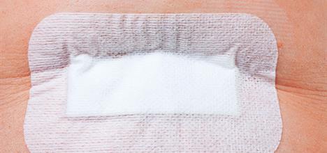 Umbilical Hernia Surgery (Herniorraphy)