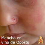Mancha en vino de Porto