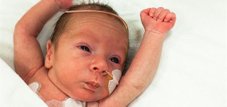 Preemie Milestones