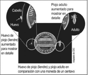 Head Lice - Image