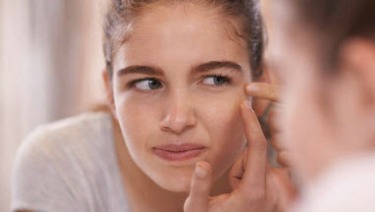 teen girl pimple